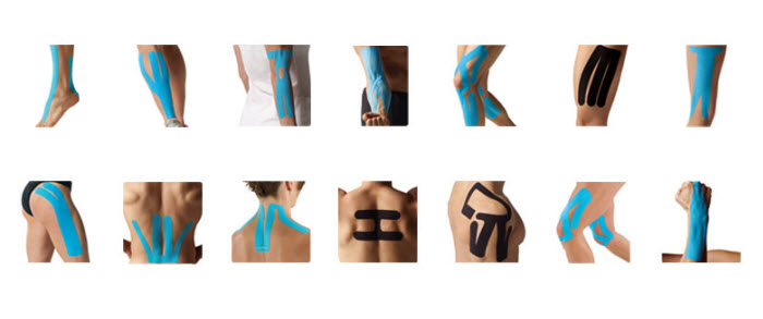 Kinesiotape