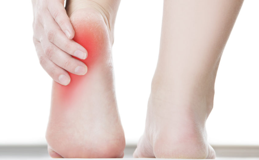 άκανθα πτέρνας